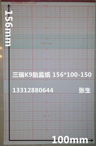 Sanrui 618K9 fetal monitor paper 156*100-150P Sanrui 618B6 fetal monitor RTB329