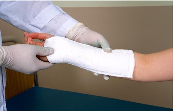 High molecular bandage splint fracture fixing can replace plaster polyurethane shaping light
