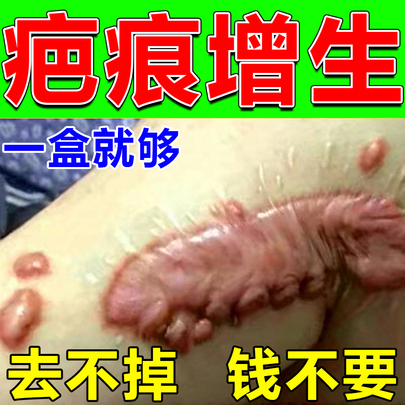 Upscale removal of Hyperplasia Scarring Bumps Soften Chest Front Scar Physique Scar Physique Scar Surgery Scar Lingu