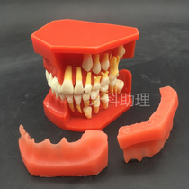 Dentistry Oral teaching Doctor-patient communication 9-12 years old milk permanent teeth alternating teeth tooth anatomy model display 7013