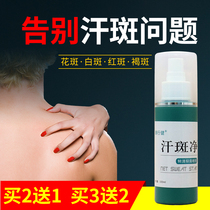 100ml sweat spots special for adult external use of tinea versicolor to Han spot ointment skin spray non-ointment