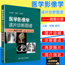 Medical Imaging Reading Sheet Diagnosis Atlas Chest Division Chest Division Zou Yugaoli Editor-in-Chief Peoples Health Press Image Medical Imaging Medical Imaging Diagnostic Atlas Chest Division Internal Medicine Diagnosis CT