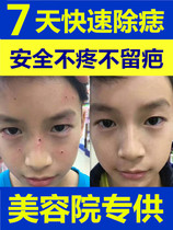 Point mole to mole the mole potion point mole paste No marks to remove the mole spot Spotted Water Freckle Nevus Pen Removing the face of the product