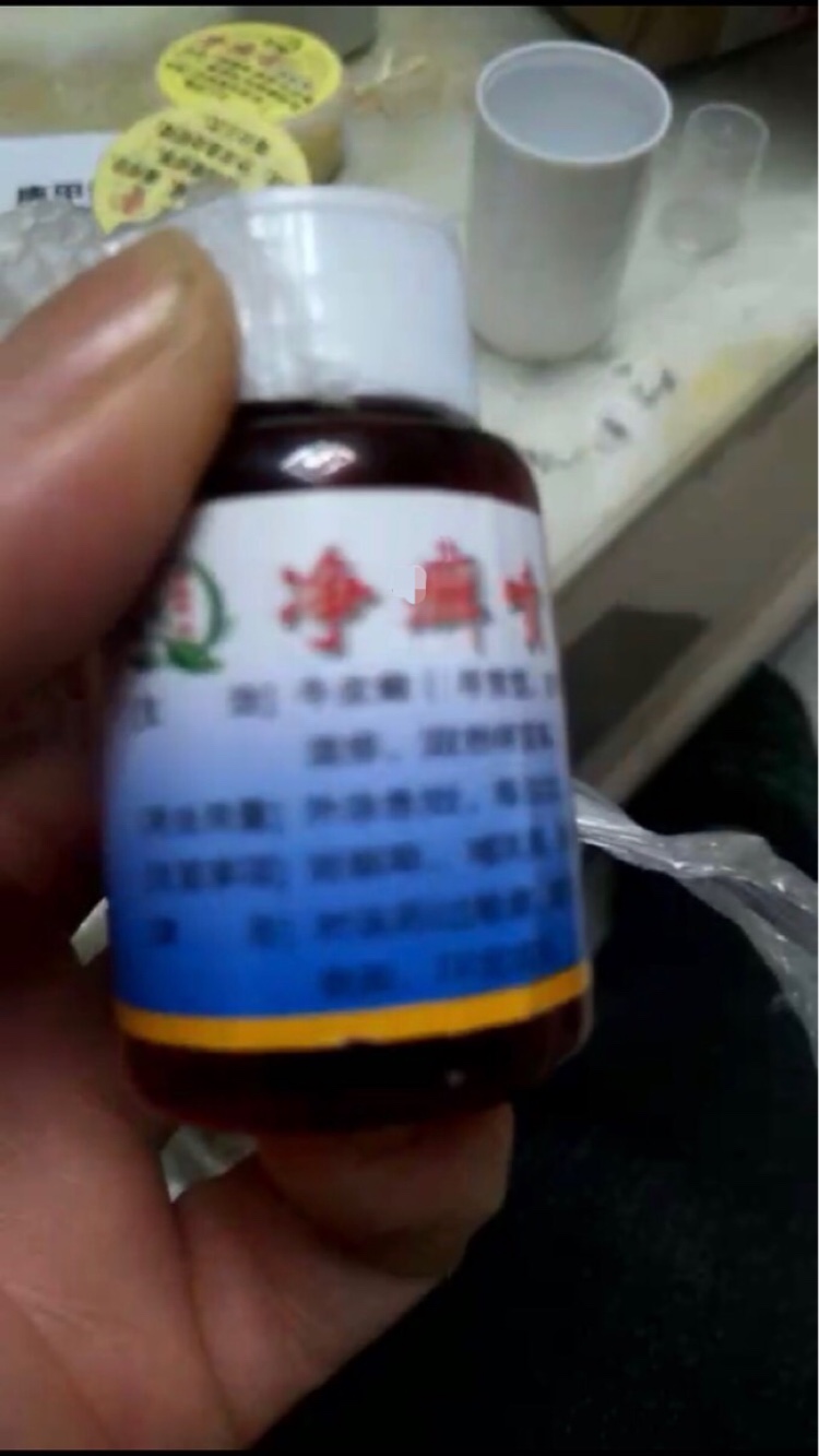 Middle All Net 100 Renate Skin Hall Net Moss to Buy a Skin Net Ringworm bacteriostatic liquid delivery paste Net moss cream