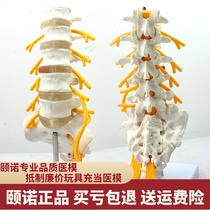 ENOVO Yinuo Medical Human Five-Section Lumbar Vertebrae Nerve Sciatic Nerve Model Spine Orthopaedic Model Spine Lumbar Anatomy Disc Spinal Nerve Display Exercise Teaching