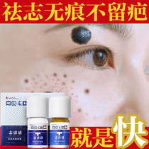 Removing the mole mole male with face unimprinted theorizer gufang plant to dispel the wart mole water to remove the black mole paste to the black mole