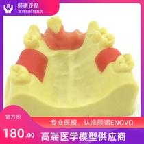 ENOVO Dental maxillary missing implant training model Oral immediate implant training Maxillary missing
