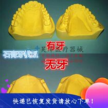 Dental Model Upper Jaw Plaster Model Yellow Plaster Model Release Dental display model