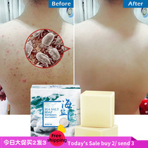 Sea Salt Soap Cleaner Anti Acne Body