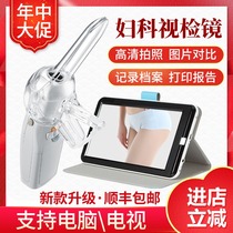 Star Angel HD colposcope Gynecological visual inspection mirror FA2 cervical examination self-examination mirror Private endoscopic testing instrument
