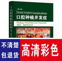 Etiological prevention and second edition of dental implant complications