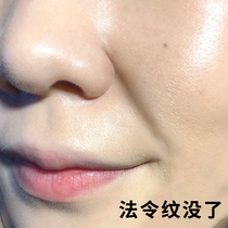 (Recommended by Li Jiaqi) law to eliminate the artifact to remove the corners of the mouth pattern 158 yuan three boxes a course of treatment