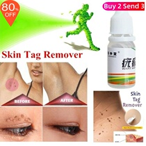 10ml Skin Tag Remover Warts Treatment Foot Care Cream Foot