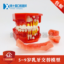 Dental dental model 5-9 years old childrens baby teeth replacement tooth model baby permanent teeth alternate display doctor-patient communication