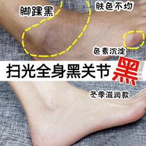 (Recommended by small red book) joint knee elbow black artifact white ankle neck underarm melanin