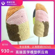 ENOVO Medical Human lung segment Lung anatomy model Respiratory system Lung segment thoracic surgery Respiratory model