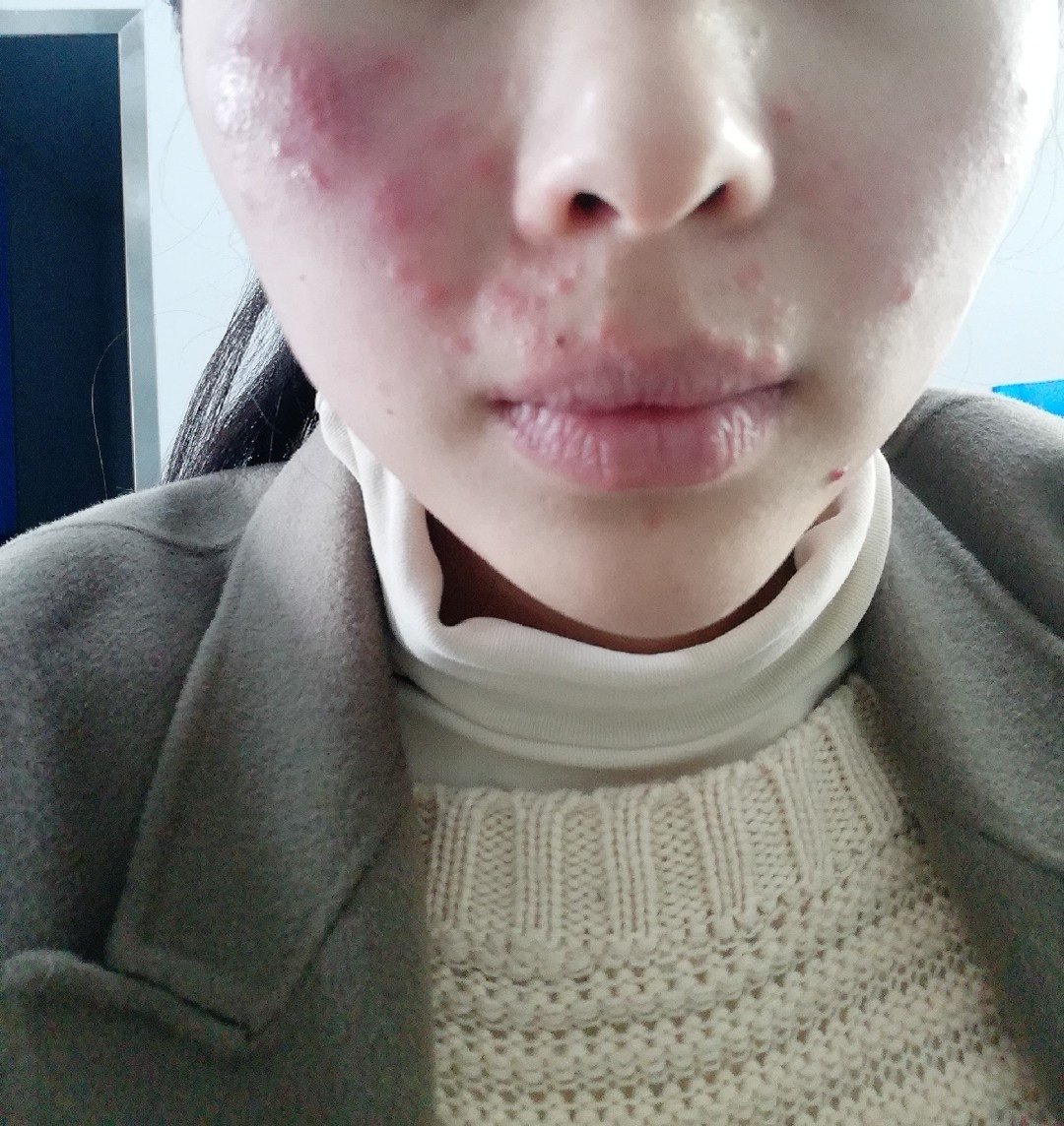 可丽金喷雾多少钱，可丽金喷雾效果怎样