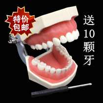 With tooth slit preparation tooth model rubber stamp oral student to prepare dental body model 28 teeth detachable to send 10 teeth