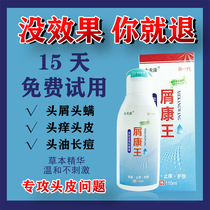 Kang Wang anti-itching and anti-dandruff shampoo Cream Anti-Dandruff artifact anti-hair hair loss fluffy oil control oil