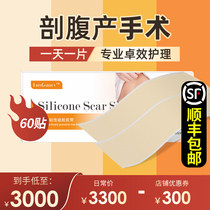 (The same section of Shanghai Private Confinement Club)60 stickers for waterproof repair of wounds after caesarean section