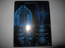 A3 medical blue film inkjet medical film new type of radioactive film CTDRX light film new type of blue film