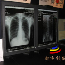 EIZO EIZO 20 inch G20 G22 medical 2m monochrome black and white gray CT professional eye protection LCD