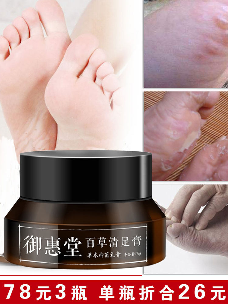 Miketo Baicao Qing Foot Cream Blisters Itchy feet Dry heel foot cream Foot care Foot cream chapped