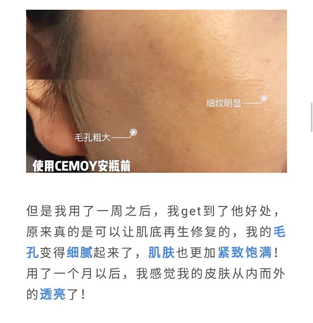 1 giây dưỡng ẩm hydifact serum ohui xanh