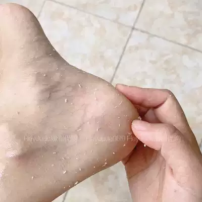 一噴去死皮日本foot Medi足部去角質噴霧去死皮腳皮角質手肘膝蓋