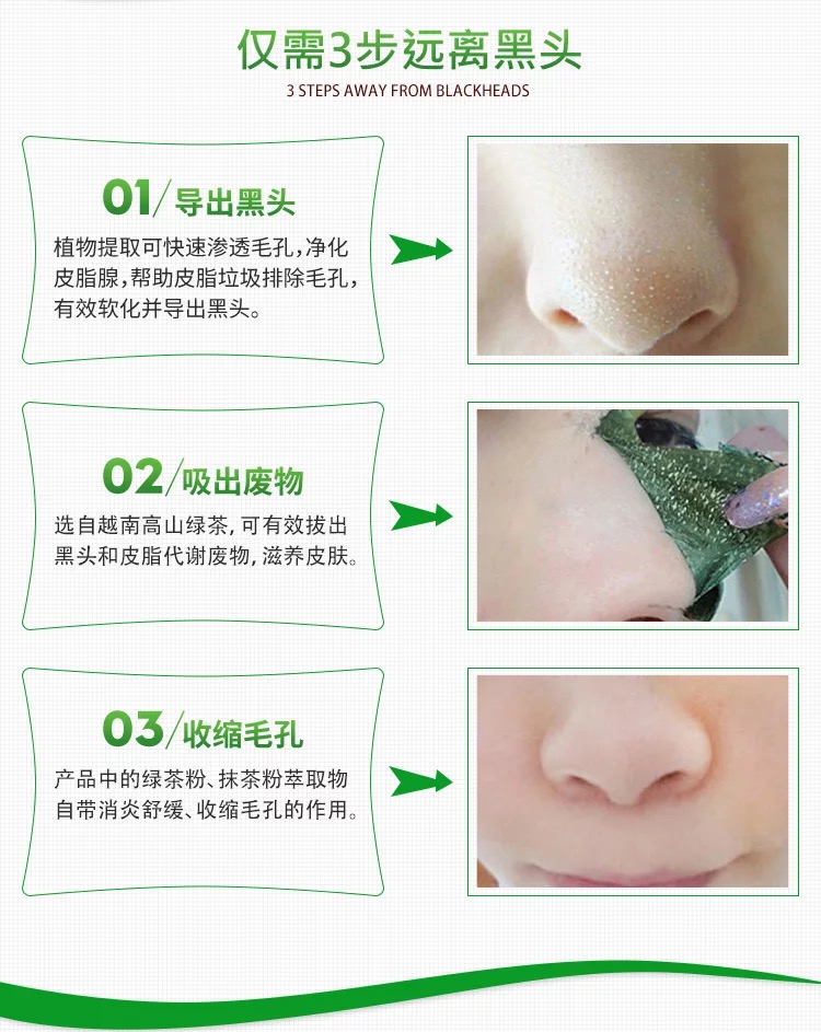 Việt Nam chính hãng Surrieo Xianyu VZA để mụn đầu đen mụn mặt nạ rách sạch lỗ chân lông thu nhỏ kiểm soát dầu mặt nạ tế bào gốc
