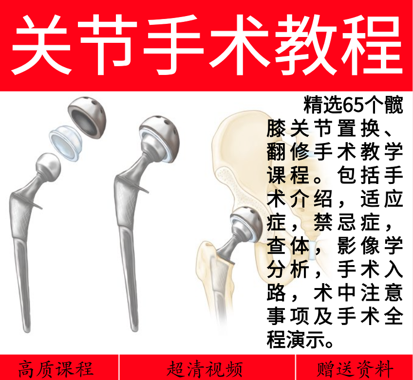 2020 Orthopedics Self Study Film Tutorial Surgery Demo Clinical Application AO Tutorial Joint Crest Post Trauma Surgery