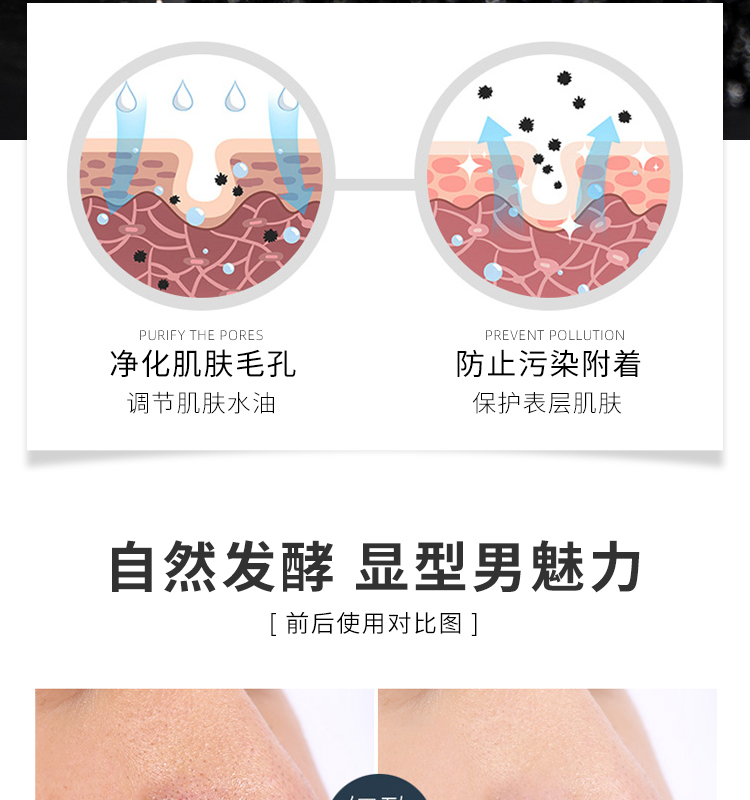 AHC Men Cleanser Cleanser KIỂM SOÁT ĐẶC BIỆT Mụn ngoài ngoài ve để đi đến mụn đầu đen để làm sạch dầu Sản phẩm chăm sóc da ACH Hàn Quốc sữa rửa mặt có độ ph thấp