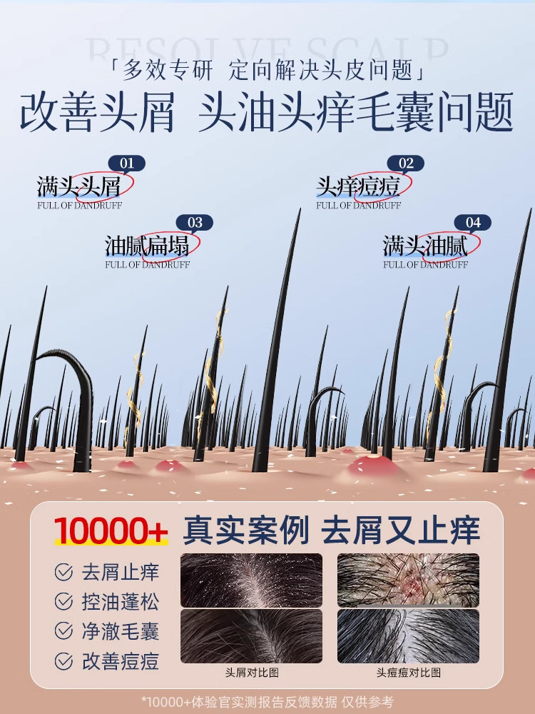 Deep Follicle Cleansing Shampoo, Anti-Dandruff, Anti-Itch, Selenium Disulfide, Oil Control, Mite Removal, Fluffy Men's and Women's Shampoo