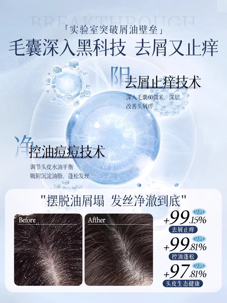 Deep Follicle Cleansing Shampoo, Anti-Dandruff, Anti-Itch, Selenium Disulfide, Oil Control, Mite Removal, Fluffy Men's and Women's Shampoo