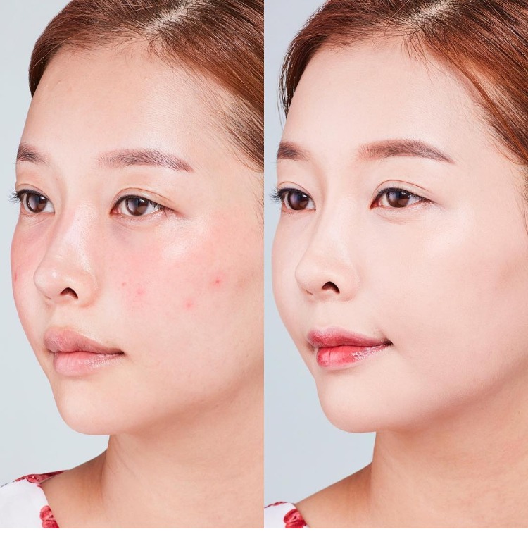 Spot Korea MIBA BB cream Hong Zhenying với cùng một loại khoáng chất canxi ion đệm giữ ẩm lâu dài bb cream nào tốt