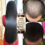 德生源 Лосьон для волос, быстрая увеличивающая краска для волос для роста волос, шампунь