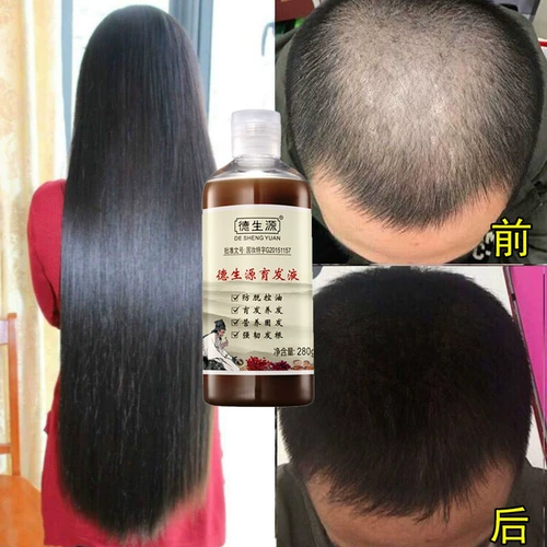 德生源 Лосьон для волос, быстрая увеличивающая краска для волос для роста волос, шампунь