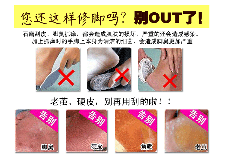 Tình yêu da, phim chân đỏ, bong tróc, chân trắng, phim chân đẹp, chăm sóc chân, tẩy da chết, da chết, ông già, 10 miếng kem ủ chà gót chân