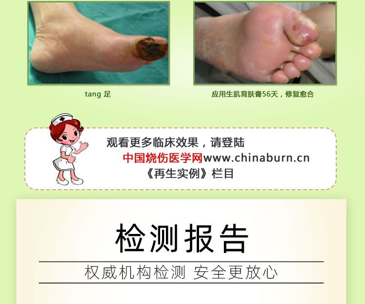 Sores Rotten Shengji ointment promotes paralyzed elderly buttocks for external use ...