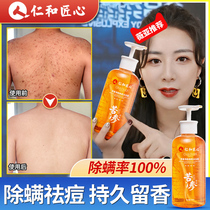 Mite removal shower gel back acne removal mite official brand men and women special chicken skin pimple