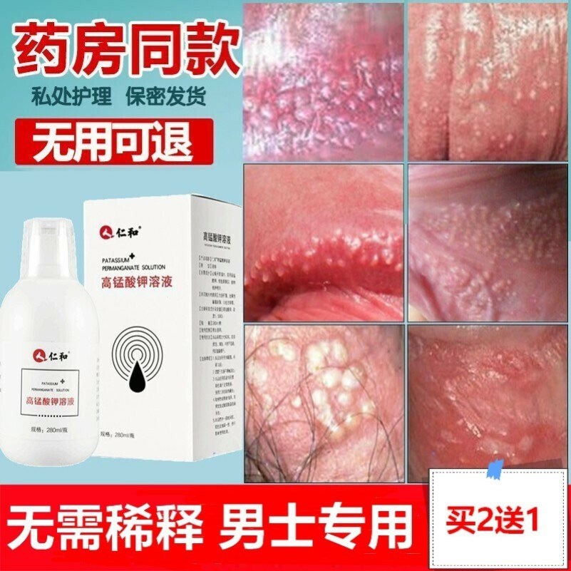 Foreskin Spray Lotion Male Potassium Permanganate Solution Clean Stop Itch Virgin Male Female Mold Flush Type Male