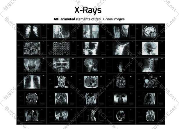 AE脚本 700组人体解剖骨骼脏器X射线HUD细胞病毒DNA动画元素 AtomX破解