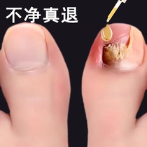 Suitable for those who are impatient (refundable if not purified). Just drop a drop of it to turn bad nails into good ones. Use potassium to cleanse your nails and enjoy a good nail life.