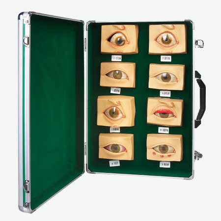 常见眼病模型20种常见眼球病变模型眼病模型