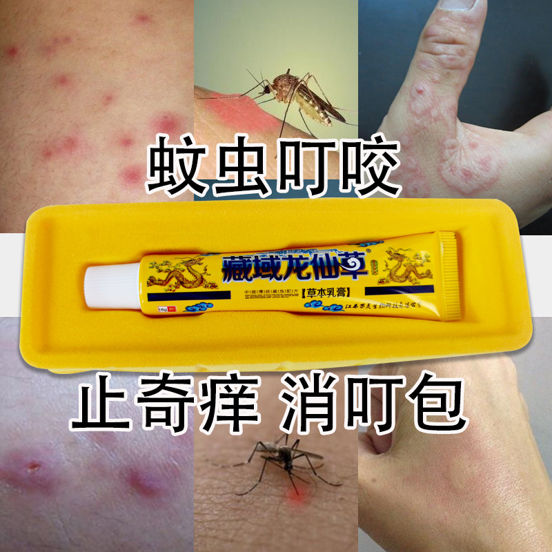 Mosquito bites, itching, swelling, adults, children, Japan, cool and soothing, quickly remove mosquitoes, bugs, fleas, antibacterial ointment
