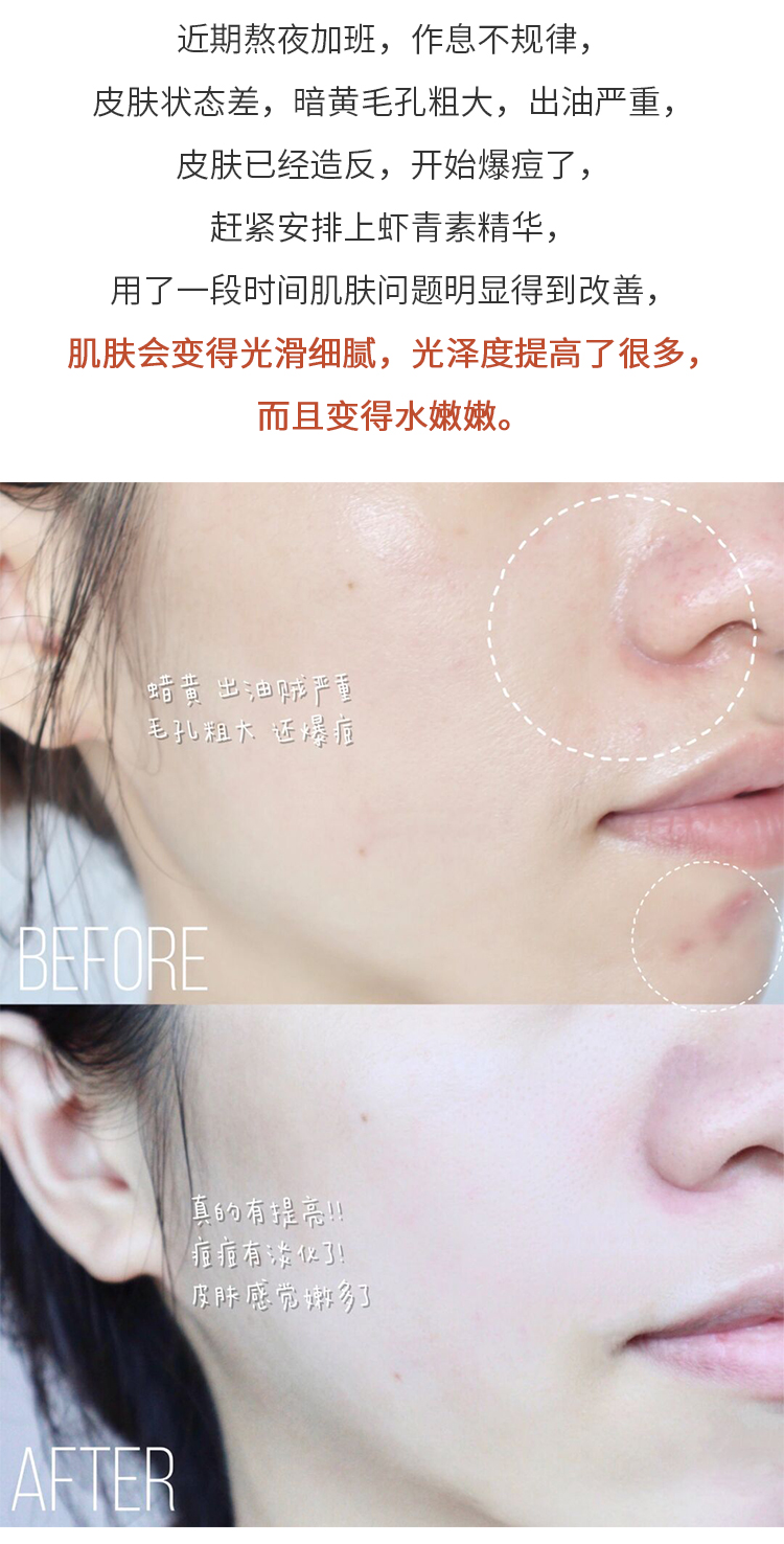 Ngôi sao Savior Haa Tôm Chống oxy hóa chống oxy hóa Chống oxy hóa Người cao tuổi Hỗ trợ cung cấp nước Cửa hàng hàng đầu 20 tinh chất vichy