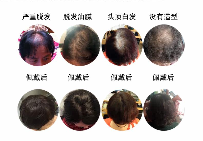 Extension cheveux - Ref 220196 Image 10