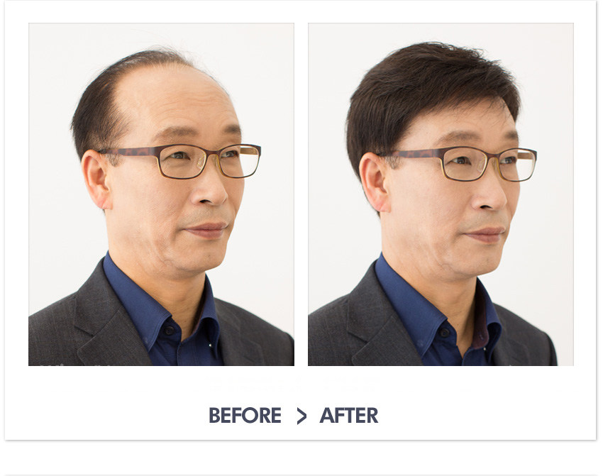 Extension cheveux - Ref 217174 Image 27