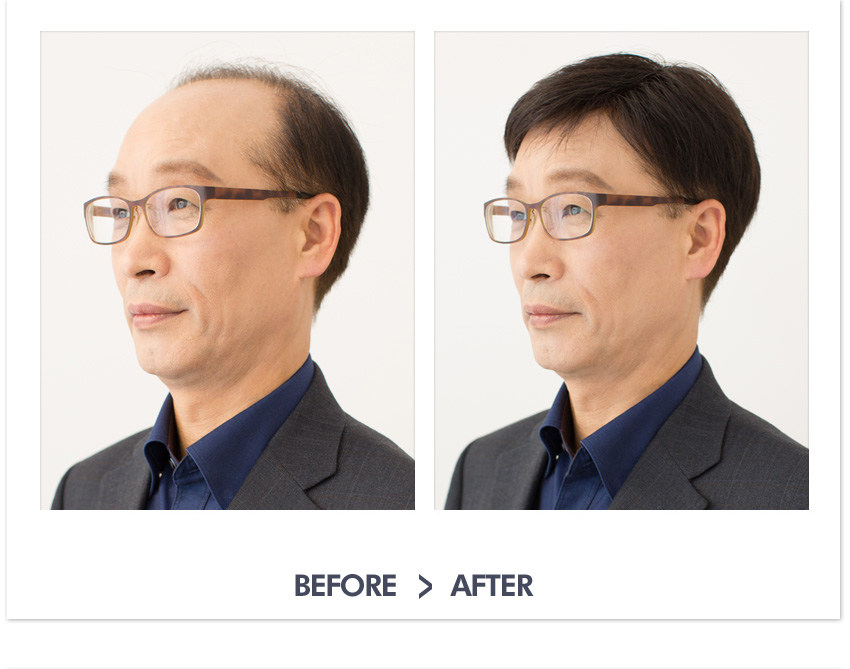 Extension cheveux - Ref 217174 Image 28