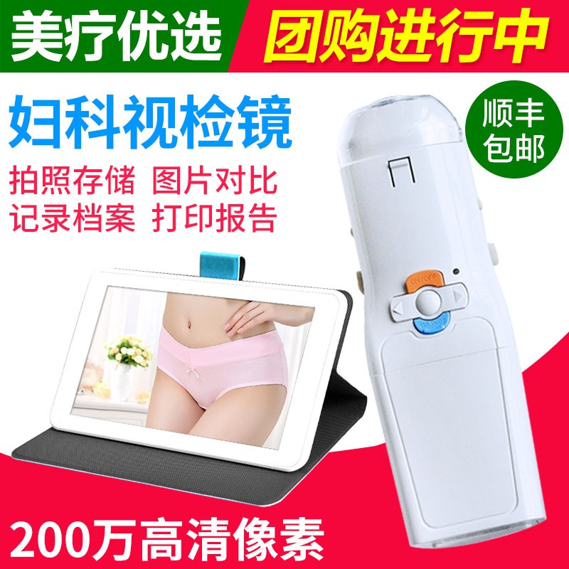 High-definition colposcopy Star Angel Women's Department video examination colposcopy cervical examination instrument speculum private endoscope